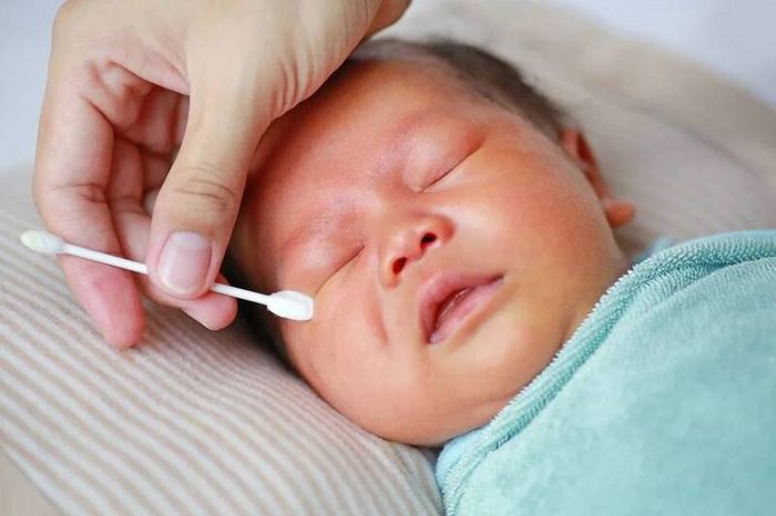 Trẻ bị tắc nghẽn tuyến lệ cần được vệ sinh mắt sạch sẽ