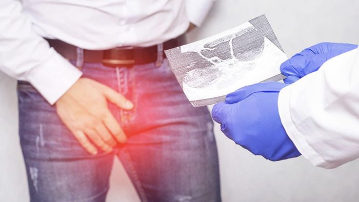 Cần tìm đến bác sĩ để được tư vấn phương án chữa trị hiệu quả cho đau tinh hoàn một bên.