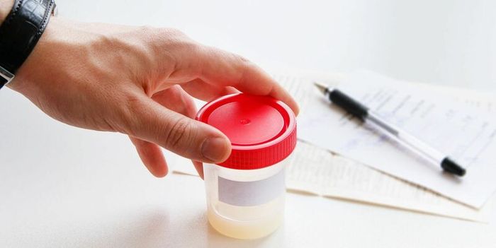 Khám vô sinh nam cần thực hiện xét nghiệm tinh dịch đồ