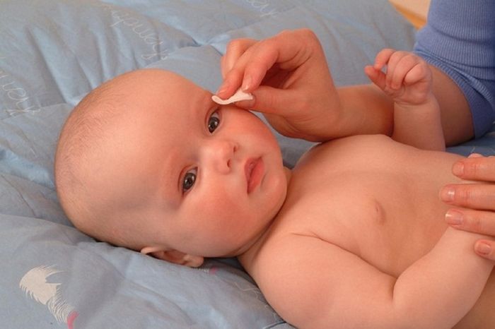 Khi nào cần mở thông tuyến lệ?