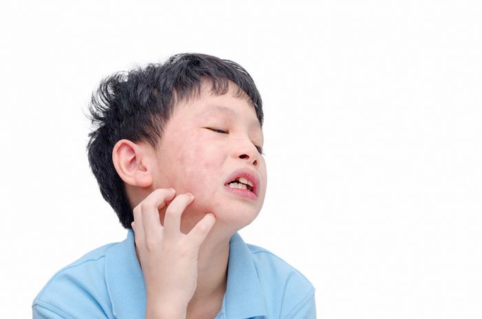 Nam giới mắc bệnh quai bị khi còn nhỏ có thể gây ra vô sinh.