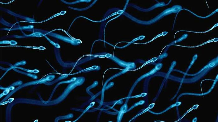 Vô sinh nam là gì và cần kiểm tra tinh trùng di động hay không