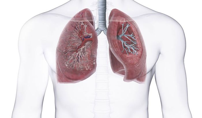 Thải độc cho màng phổi không được thực hiện đối với bệnh nhân rò phế quản