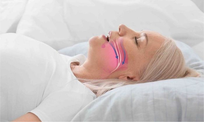 Rối loạn tín hiệu từ não đến cơ hô hấp có thể dẫn đến ngừng thở.