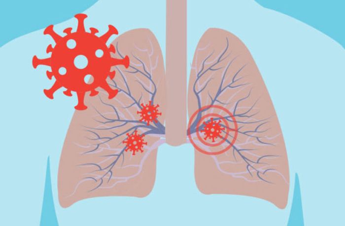 Vi khuẩn xâm nhập vào hệ hô hấp và gây tắc nghẽn đường thở