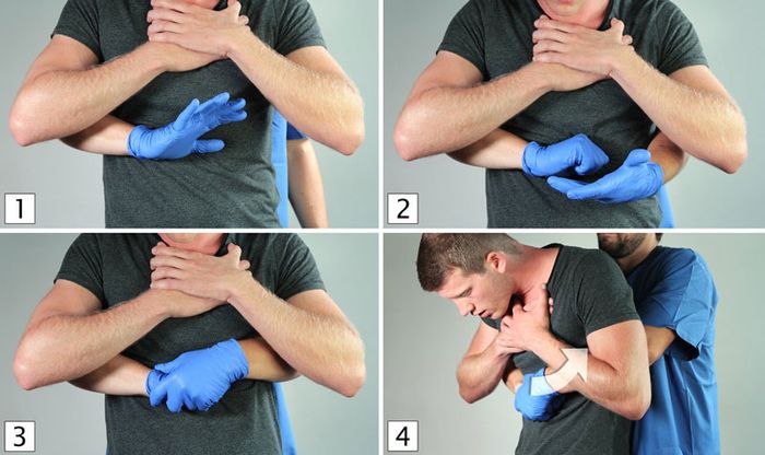 Các bước xử lý dị vật đường thở với người lớn