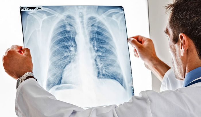 Trong giai đoạn toàn phát, phổi của bệnh nhân bị tổn thương nghiêm trọng