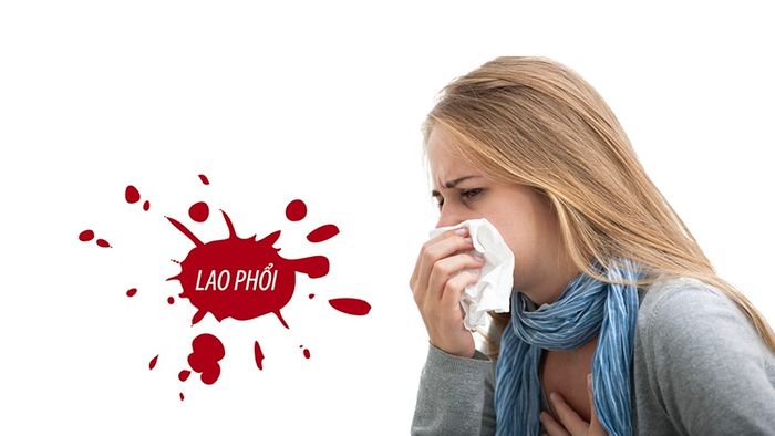 Để phòng ngừa lao phổi, mọi người cần chú ý những điều sau