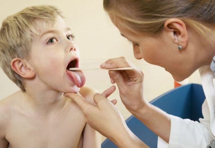 Bệnh Bạch Cầu Đơn Nhân Thường Xuất Hiện Ở Trẻ Nhỏ Và Gây Ra Triệu Chứng Viêm Họng