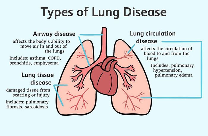 Nhiều yếu tố có thể đe dọa chức năng của phổi