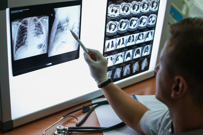 Trung bình mỗi bệnh nhân COPD có 5 bệnh đồng kèm