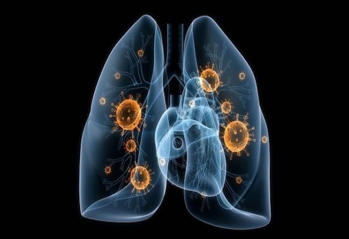 Virus hoặc vi khuẩn là nguyên nhân gây ra các bệnh hô hấp thường gặp khi giao mùa.