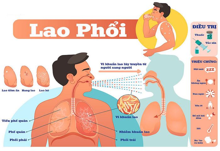 Người suy giảm hệ miễn dịch như những người mắc bệnh HIV/AIDS, bệnh về gan, hoặc đã từng ghép tạng có nguy cơ cao hơn trong việc nhiễm bệnh lao phổi.