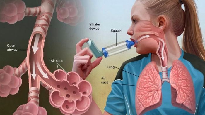 Các nguyên nhân có thể gây ra bệnh