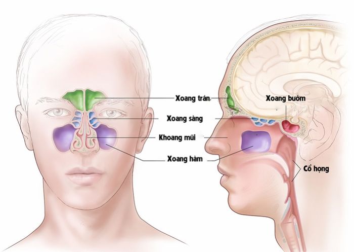 Viêm xoang sàng sau là tình trạng viêm nhiễm của xoang mũi sàng sau.
