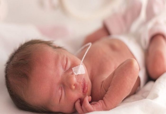 Suy hô hấp ở trẻ sơ sinh, còn được biết đến với tên gọi bệnh màng trong (RDS), là một vấn đề phổ biến thường gặp ở trẻ sinh non.