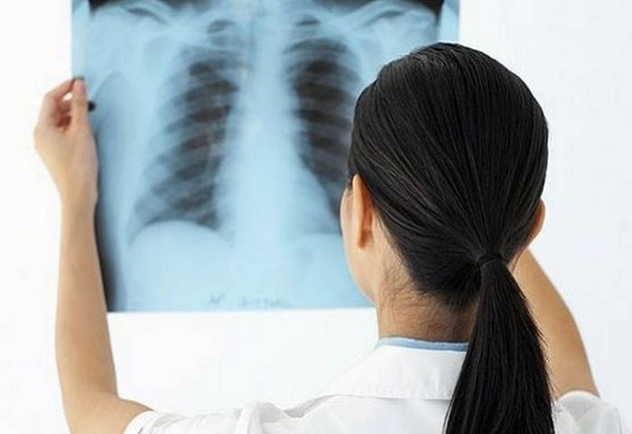 Sử dụng X-quang để phát hiện tổn thương trong phổi một cách rõ ràng.