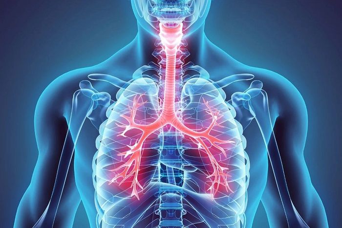 Ho có đàm xanh có thể là biểu hiện của tình trạng bệnh phổi tắc nghẽn mạn tính bội nhiễm
