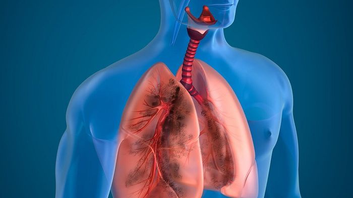 CT scan phổi tạo ra hình ảnh chi tiết và chân thực