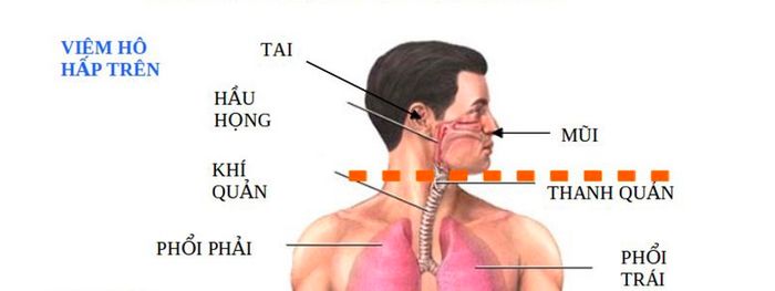 Bạn hiểu gì về viêm đường hô hấp trên?