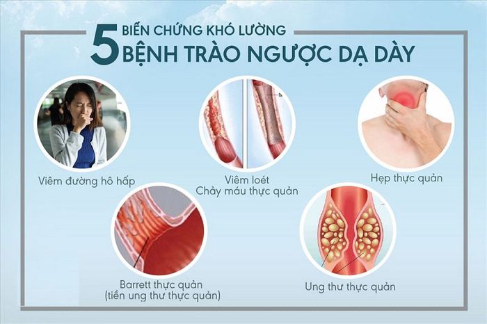 5 tác động phụ khi bị trào ngược dạ dày, thực quản