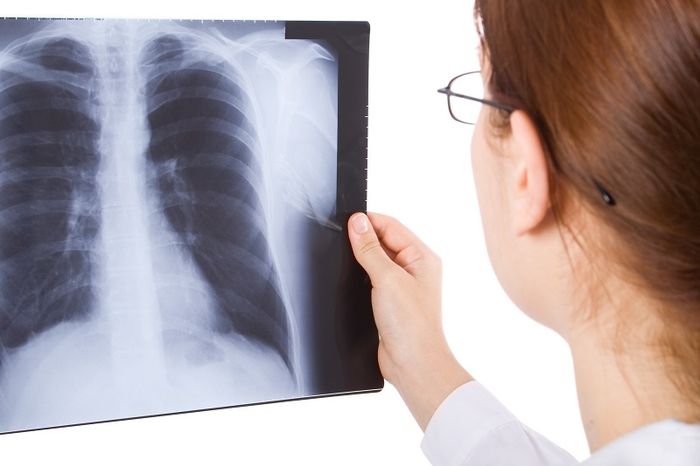 Nguy Cơ Viêm Phế Quản Cấp Với Môi Trường Ô Nhiễm
