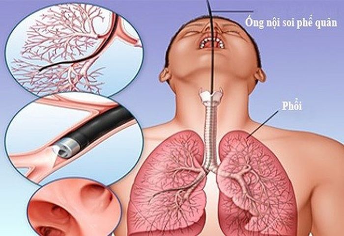 Để được khám và điều trị bệnh về phổi một cách hiệu quả, quý vị nên lựa chọn cơ sở y tế uy tín và đáng tin cậy.
