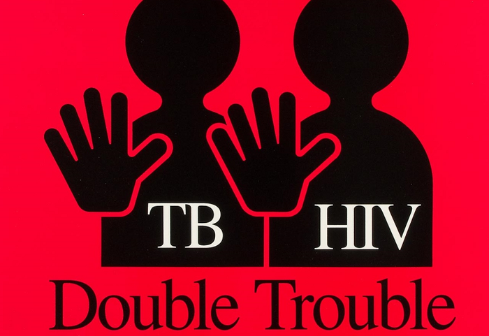 Người nhiễm HIV có thể là yếu tố dẫn đến bệnh lao