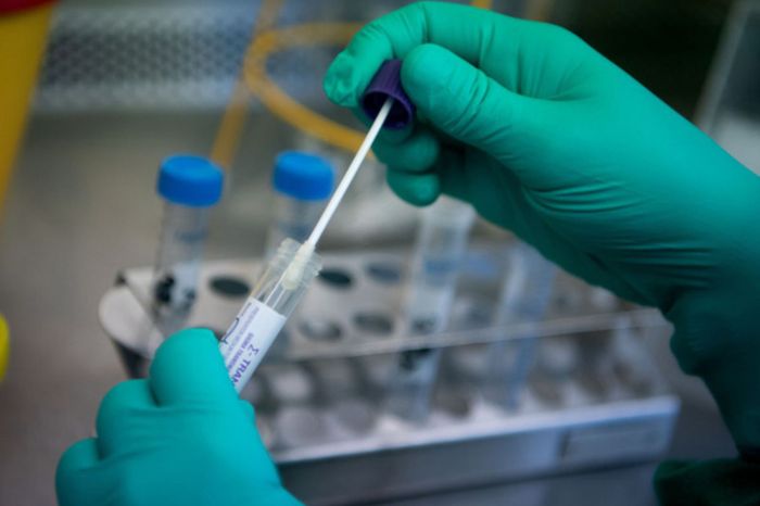 Xét Nghiệm Dịch Hô Hấp Giúp Chẩn Đoán Chính Xác Virus Hợp Bào Hô Hấp