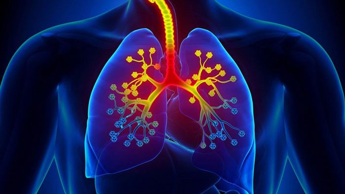 Hen phế quản là một loại bệnh mạn tính