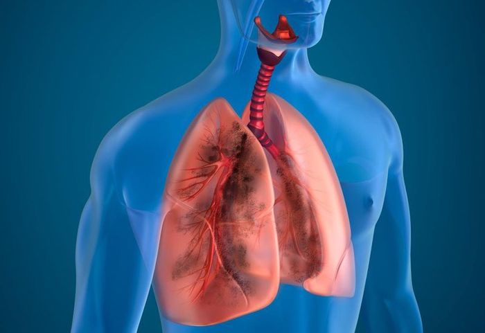 Hiểu rõ về các bệnh về phổi sẽ giúp chúng ta phòng tránh những nguy cơ này tốt hơn