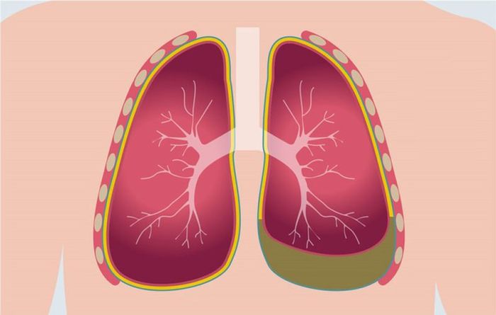 Uống rượu vào buổi sáng và những rủi ro đi kèm