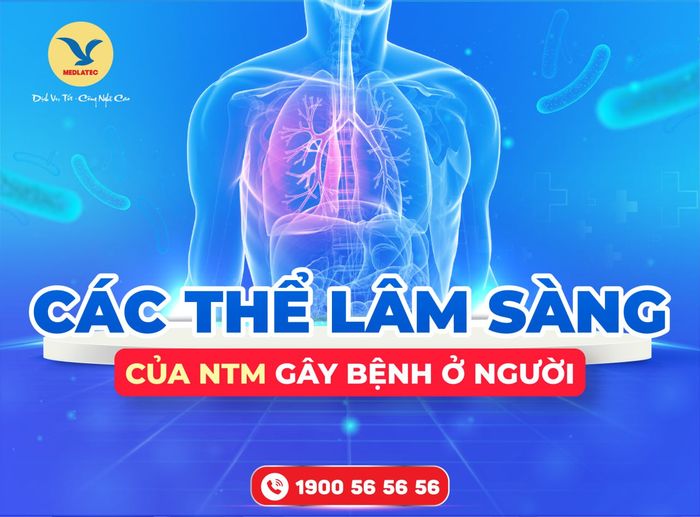 Các dạng lâm sàng của NTM gây bệnh ở con người