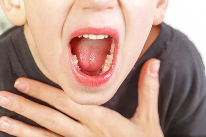 Sưng viêm Amidan có thể là nguyên nhân của việc trẻ bị ngủ ngáy