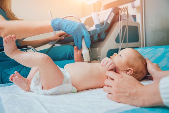 Bệnh phổi bẩm sinh là một nhóm dạng dị hình bẩm sinh thường gặp