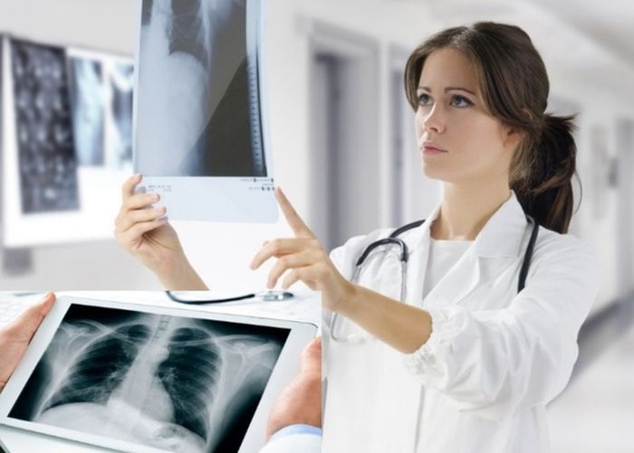 Chụp X-quang là phương pháp chẩn đoán hình ảnh thường được áp dụng cho bệnh nhân mắc tràn khí màng phổi