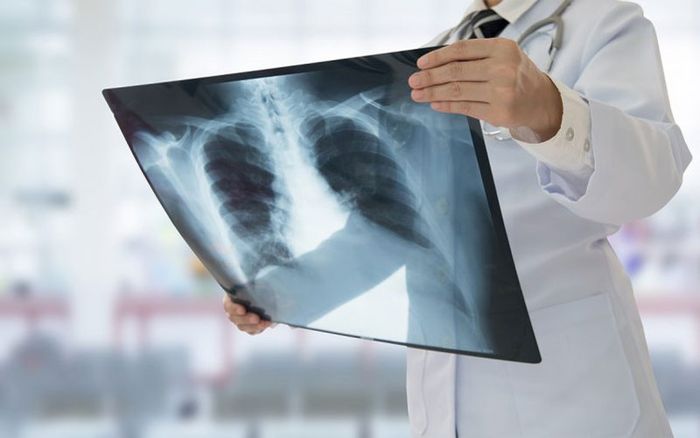 X-quang ngực giúp bác sĩ đánh giá tình trạng sức khỏe của bệnh nhân
