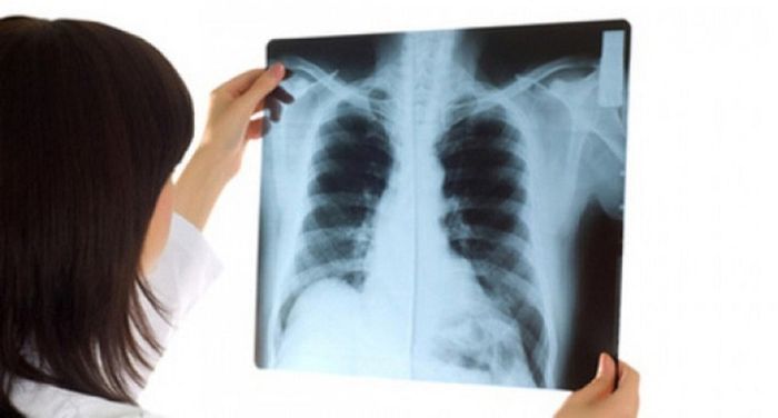 tiến hành chẩn đoán hình ảnh để phát hiện nguyên nhân gây ra tình trạng khó thở