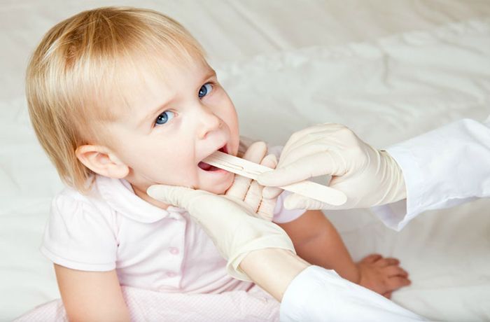 Viêm amidan là vấn đề thường gặp ở trẻ nhỏ