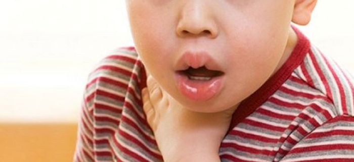 Tình trạng này rất giống với sự sặc thông thường, vì vậy bạn cần phải chú ý và tránh nhầm lẫn.