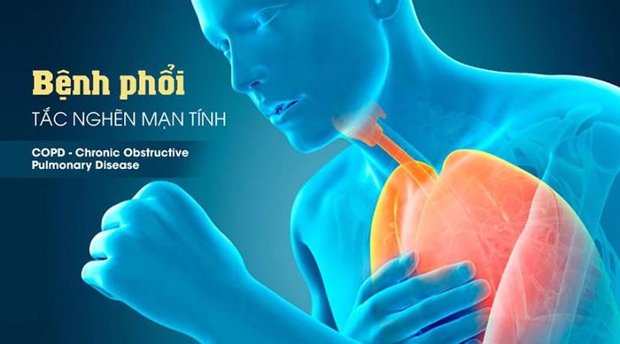 Bệnh phổi tắc nghẽn mạn tính có khả năng chữa được không