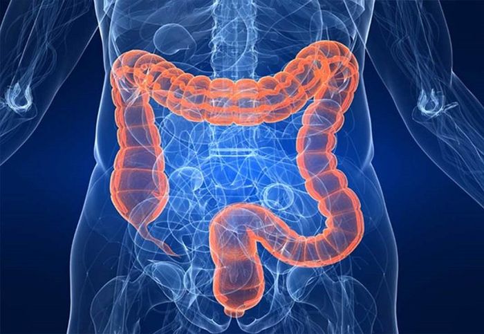 Cấu trúc đại tràng gây ra nhiều khó khăn trong việc chẩn đoán bệnh