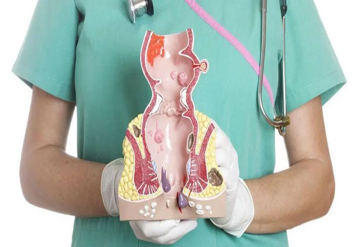 Vùng hậu môn trực tràng thường dễ mắc các bệnh lý do thường xuyên tiếp xúc với chất thải.