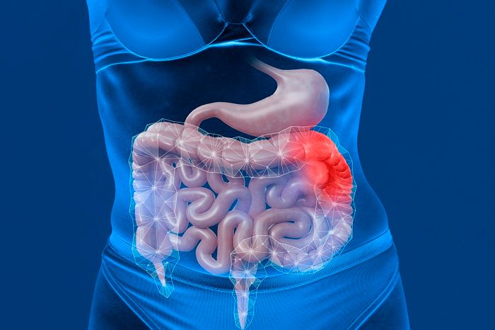 Tắc ruột cũng có thể gây ra các biến chứng như sốt đau bụng, đi ngoài, và buồn nôn.