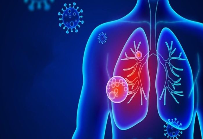 Có rất nhiều nguyên nhân gây ra suy hô hấp giảm oxy