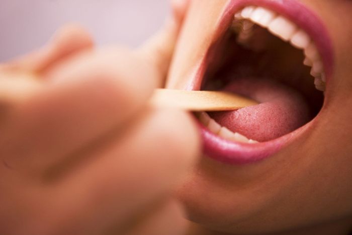 Nên đi khám ngay để được điều trị và tránh nguy cơ biến chứng