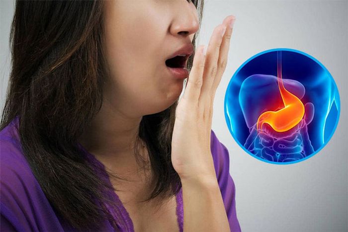 Trào ngược dạ dày và dịch mật gây ra mùi hôi và vị đắng trong miệng.