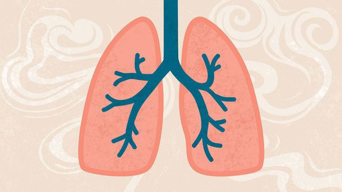 Viêm phổi do virus có thể gây ra tình trạng hụt hơi.