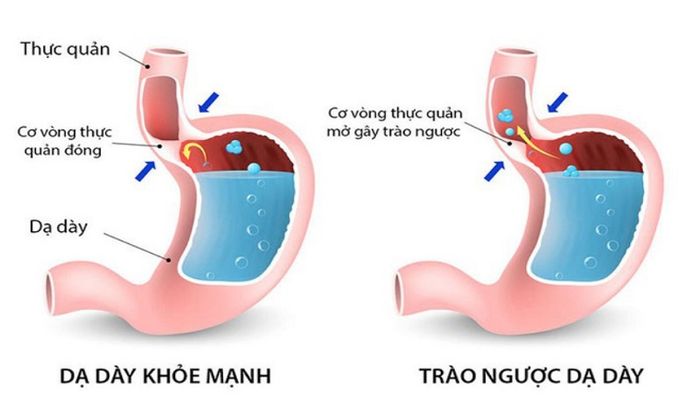 triệu chứng khó thở và mệt mỏi