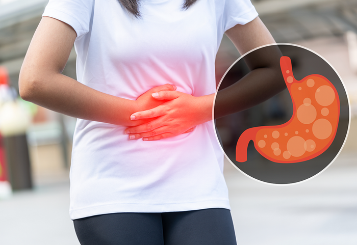 Dư axit dạ dày có thể có nhiều nguyên nhân khác nhau.